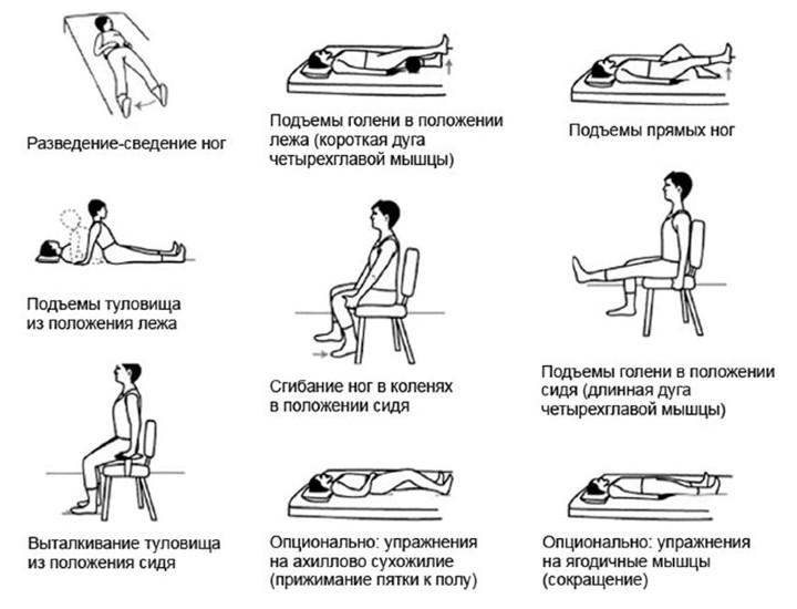 Упражнения после эндопротезирования тазобедренного сустава