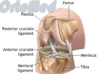растяжения разрывы связок коленного сустава