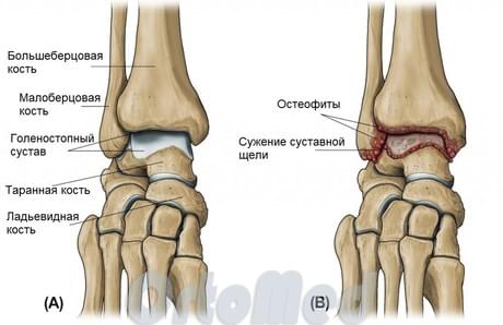 анатомия голеностопного сустава