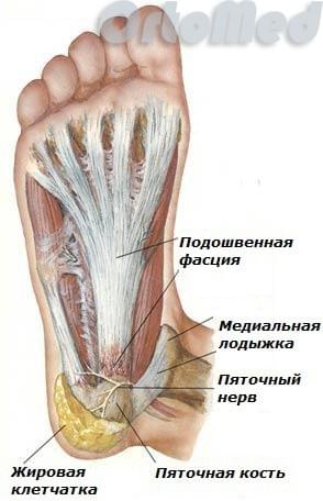 Подошвенный фасциит