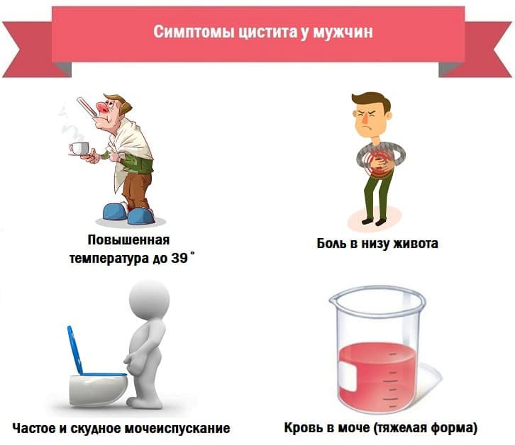 цистит у мужчин симптомы