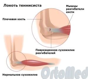 анатомия локтевого сустава